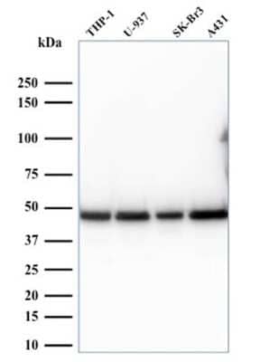 Western Blot: RPSA Antibody (RPSA/2699) [NBP2-79720]