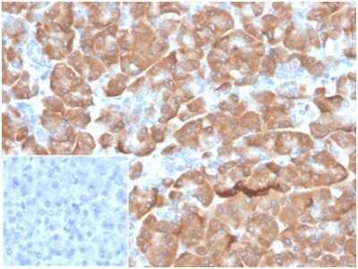 Immunohistochemistry-Paraffin: RPSA Antibody (RPSA/6332R) [NBP3-13958]