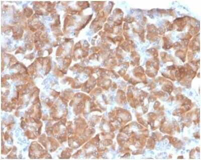 Immunohistochemistry-Paraffin: RPSA Antibody (RPSA/6332R) [NBP3-13958]