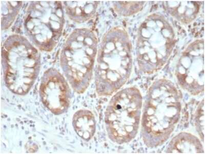 Immunohistochemistry-Paraffin: RPSA Antibody (RPSA/6332R) [NBP3-13958]