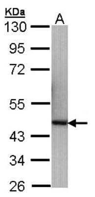 Western Blot: p40 Antibody [NBP1-32956]