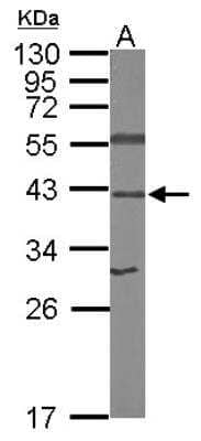 Western Blot: RPSA Antibody [NBP1-33002]