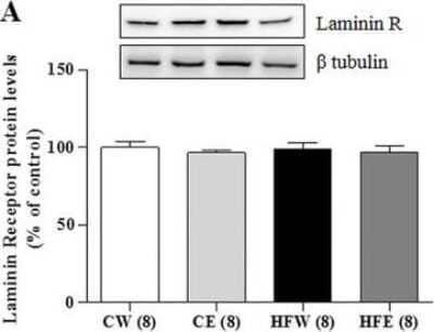 Western Blot: RPSA Antibody [NBP1-33002]