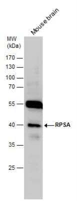 Western Blot: RPSA Antibody [NBP1-33002]