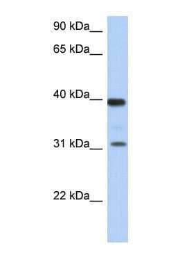 Western Blot: RPSA Antibody [NBP1-59114]