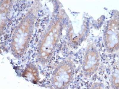 Immunohistochemistry-Paraffin: RPSA Antibody (rRPSA/6333) - Azide and BSA Free [NBP3-08266]