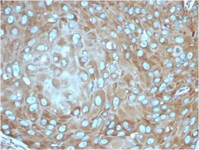 Immunohistochemistry-Paraffin: RPSA Antibody (rRPSA/6333) - Azide and BSA Free [NBP3-08266]