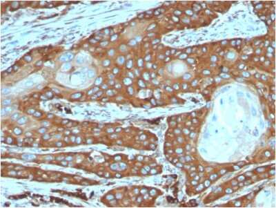 Immunohistochemistry-Paraffin: RPSA Antibody (rRPSA/6333) - Azide and BSA Free [NBP3-08266]