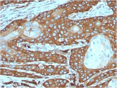 Immunohistochemistry-Paraffin: RPSA Antibody (rRPSA/6333) [NBP3-07247]