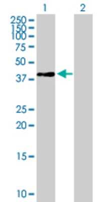 Western Blot: RPSAP58 Antibody [H00388524-B01P]