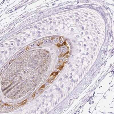 Immunohistochemistry-Paraffin: RPTN Antibody [NBP1-93792]
