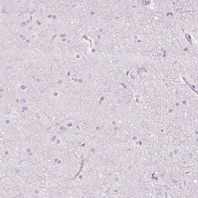 Immunohistochemistry-Paraffin: RPTN Antibody [NBP1-93792]