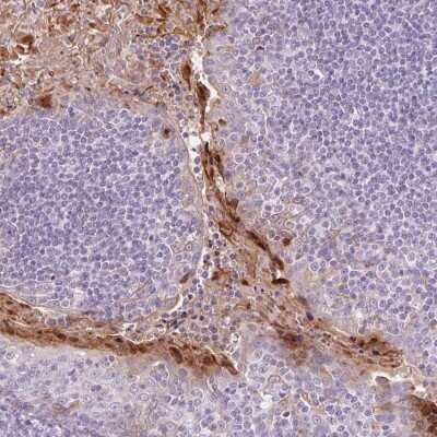 Immunohistochemistry-Paraffin: RPTN Antibody [NBP1-93792]