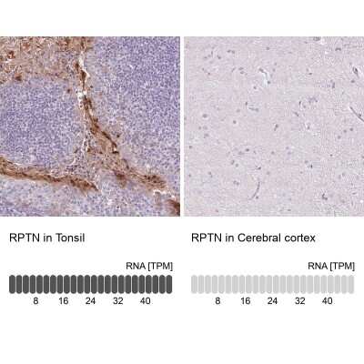 Immunohistochemistry-Paraffin: RPTN Antibody [NBP1-93792]