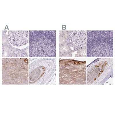 Immunohistochemistry-Paraffin: RPTN Antibody [NBP1-93792]