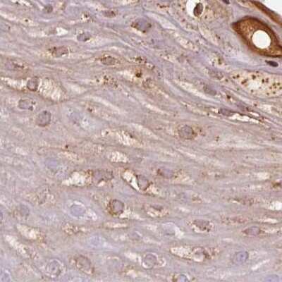 Immunohistochemistry-Paraffin: RPTN Antibody [NBP1-93792]