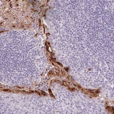 Immunohistochemistry-Paraffin: RPTN Antibody [NBP2-38159]