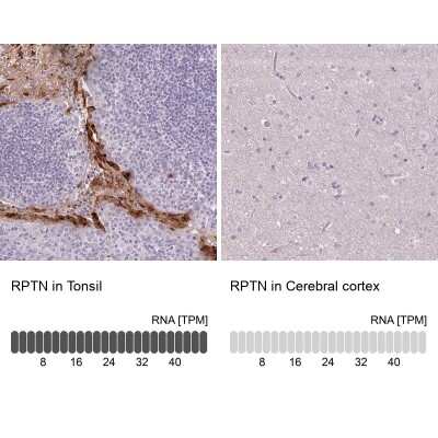 Immunohistochemistry-Paraffin: RPTN Antibody [NBP2-38159]