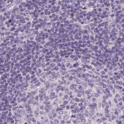 Immunohistochemistry-Paraffin: RPTN Antibody [NBP2-38159]