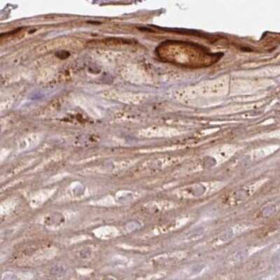 Immunohistochemistry-Paraffin: RPTN Antibody [NBP2-38159]