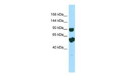 Western Blot: RPTN Antibody [NBP2-85674]