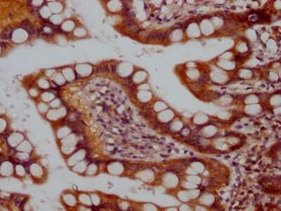 Immunohistochemistry: RPTOR Antibody (1B10) [NBP3-15202]