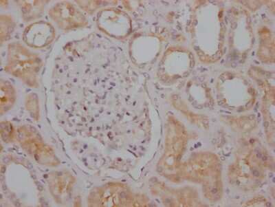 Immunohistochemistry: RPTOR Antibody (1B10) [NBP3-15202]