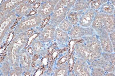 Immunohistochemistry-Paraffin: RPTOR Antibody (9N0A4) [NBP3-16729]