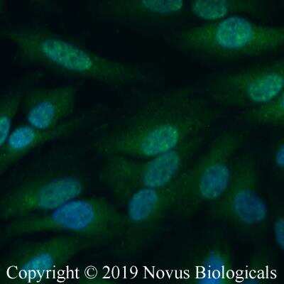 Immunocytochemistry/ Immunofluorescence: RPTOR Antibody [NBP2-24837]