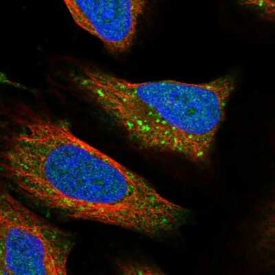 Immunocytochemistry/ Immunofluorescence: RPTOR Antibody [NBP2-56133]