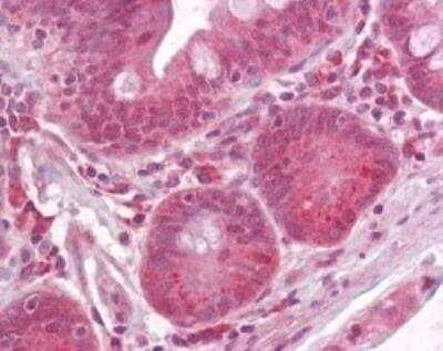 Immunohistochemistry-Paraffin: RPTOR Antibody [NBP2-24837]