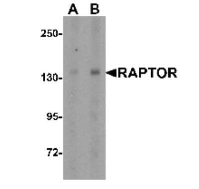 Western Blot: RPTOR AntibodyBSA Free [NBP1-77211]