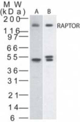 Western Blot: RPTOR Antibody [NBP2-24837]