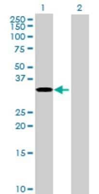 Western Blot: RPUSD1 Antibody [H00113000-B01P]