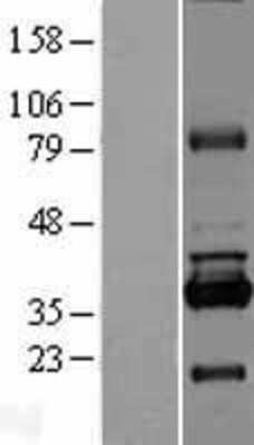 Western Blot: RPUSD1 Overexpression Lysate [NBL1-15580]