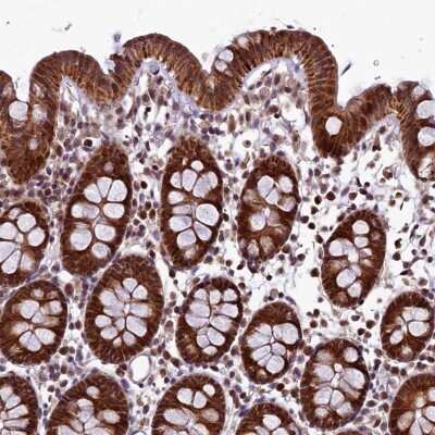 Immunohistochemistry-Paraffin: RPUSD2 Antibody [NBP1-88437]
