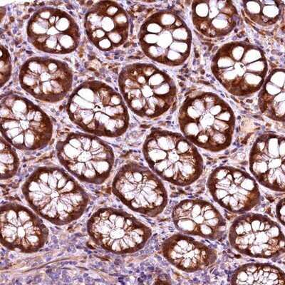 Immunohistochemistry-Paraffin: RPUSD2 Antibody [NBP1-88438]