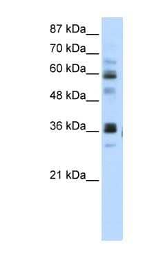 Western Blot: RPUSD2 Antibody [NBP1-80477]