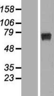 Western Blot: RPUSD2 Overexpression Lysate [NBL1-15581]