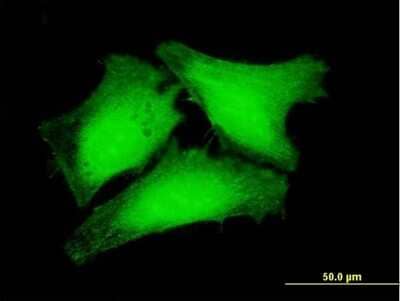 Immunocytochemistry/ Immunofluorescence: RPUSD3 Antibody [H00285367-B01P]