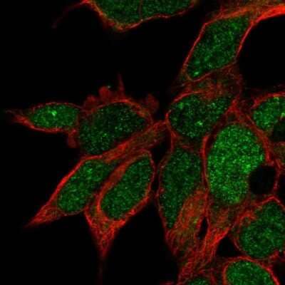 Immunocytochemistry/ Immunofluorescence: RPUSD3 Antibody [NBP2-32685]