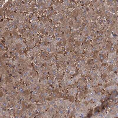 Immunohistochemistry: RPUSD3 Antibody [NBP2-32685]