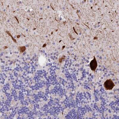Immunohistochemistry-Paraffin: RPUSD3 Antibody [NBP1-81135]