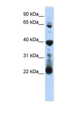 Western Blot: RPUSD3 Antibody [NBP1-80483]