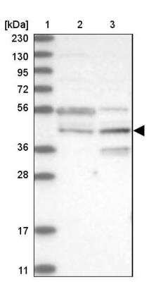 Western Blot: RPUSD3 Antibody [NBP1-81135]