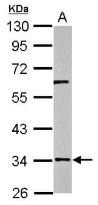 Western Blot: RPUSD3 Antibody [NBP2-20229]