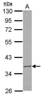 Western Blot: RPUSD3 Antibody [NBP2-20230]