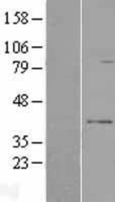 Western Blot: RPUSD3 Overexpression Lysate [NBL1-15582]