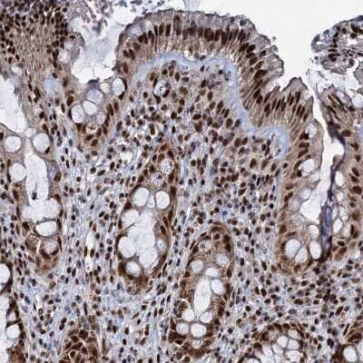 Immunohistochemistry-Paraffin: RPUSD4 Antibody [NBP1-82231]