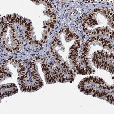 Immunohistochemistry-Paraffin: RPUSD4 Antibody [NBP1-82231]